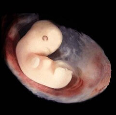IMC - Embryology