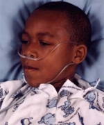 Tyrone James - PediatricSickle Cell Anemia